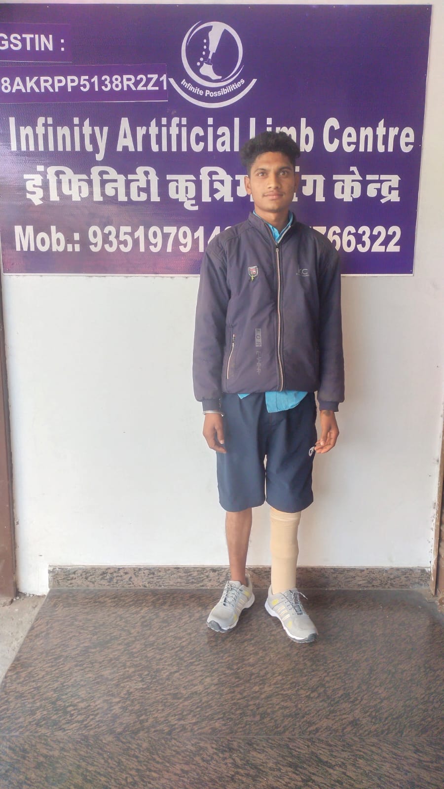 Amputee patient testing a dynamic response prosthetic limb socket for stability and balance